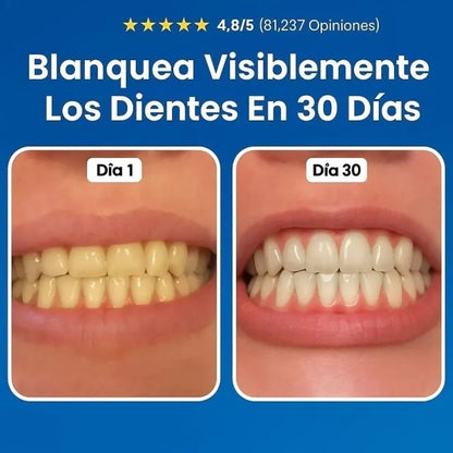 Nudenta - Restauración Total de tu Sonrisa